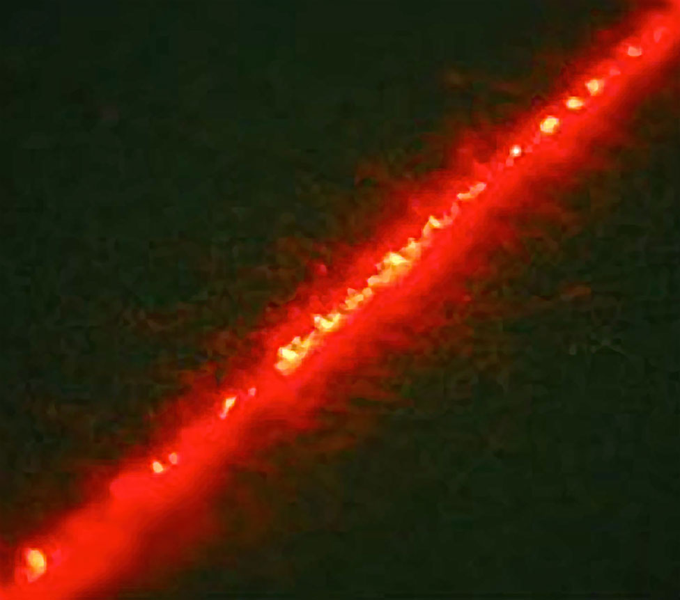 laser image