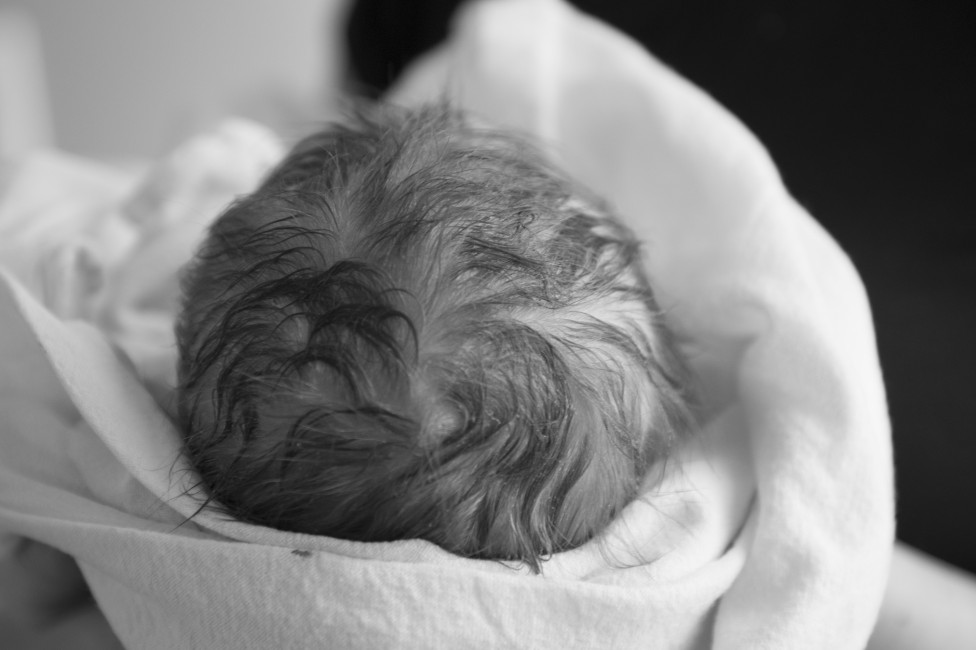 A black and white photo of a newborn's head